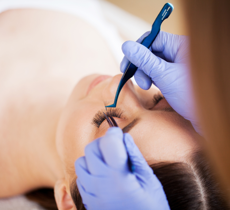 Brow Lift before and after illustration