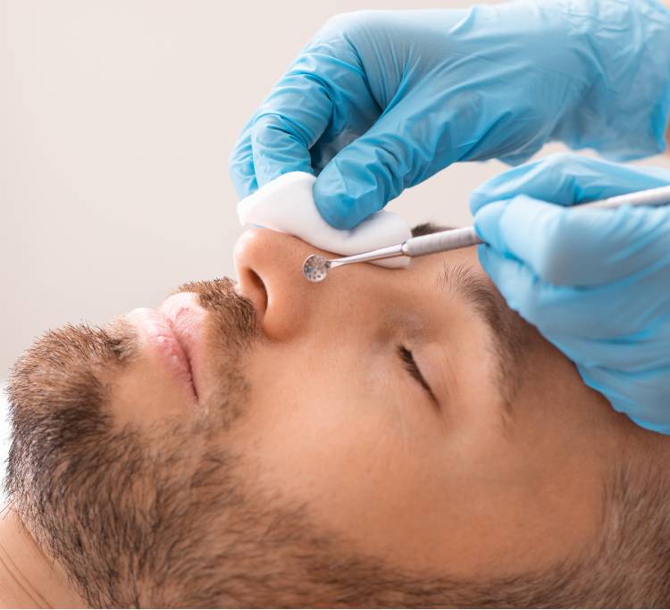 Nose surgery preparation