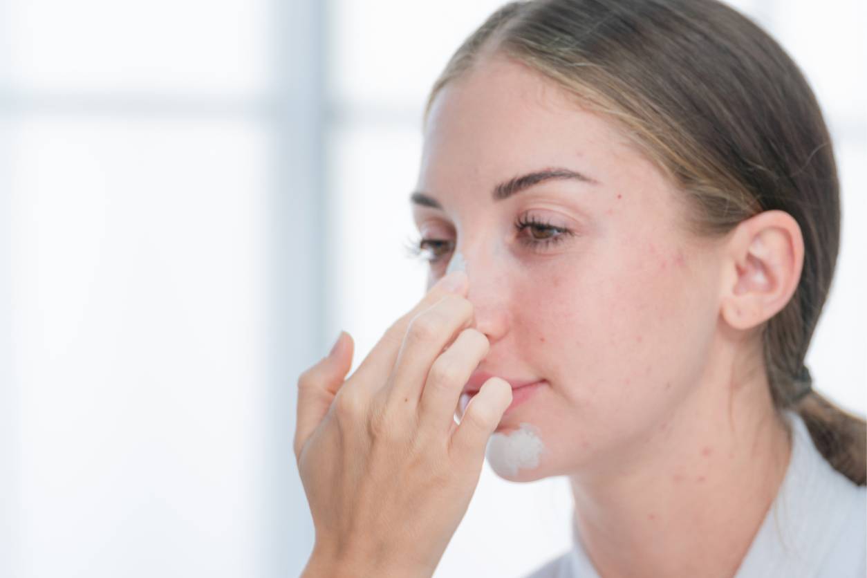 Epistaxis treatment illustration