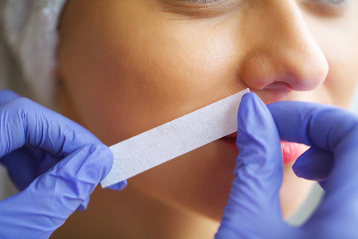 Sino-nasal polyps surgery